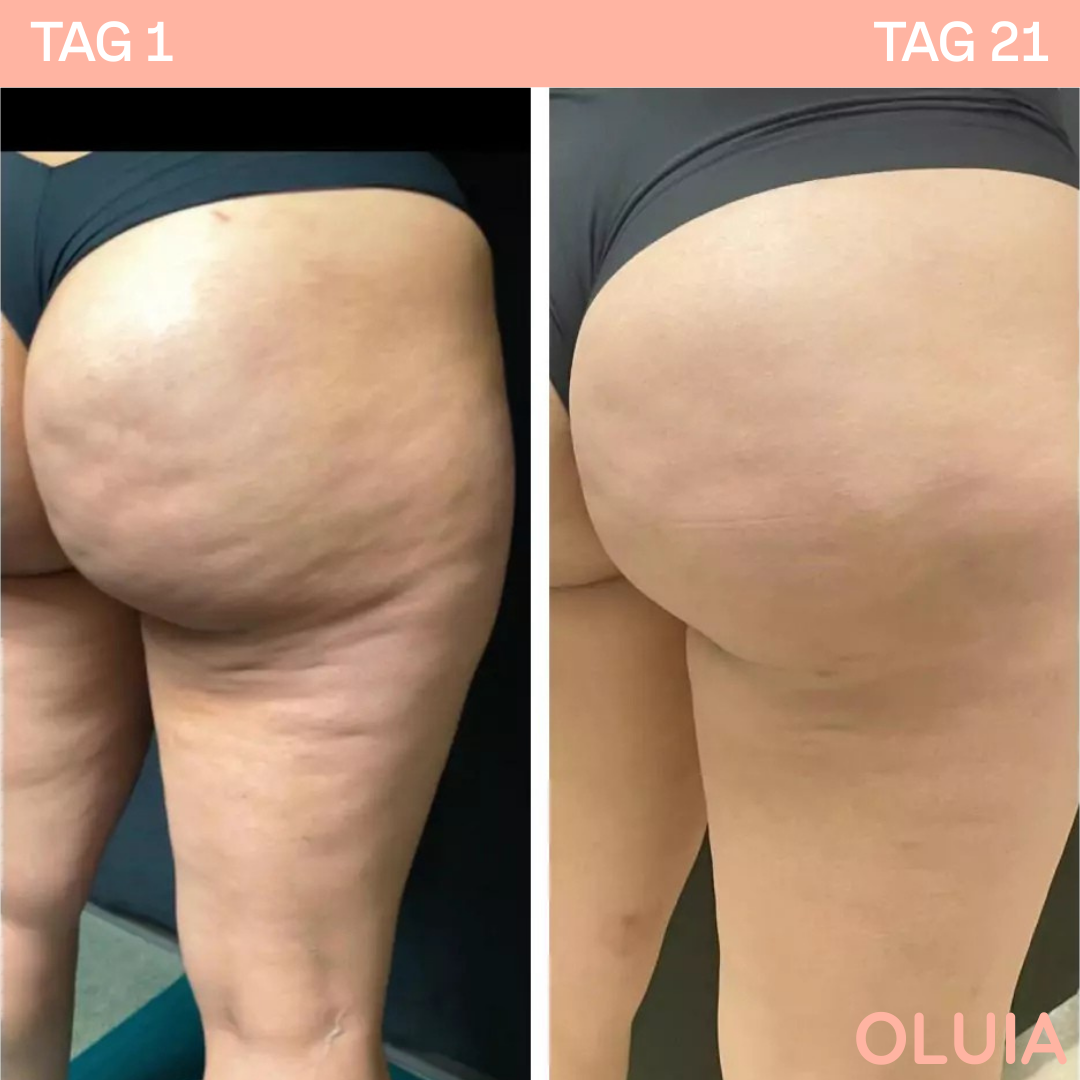 SculptiGlow